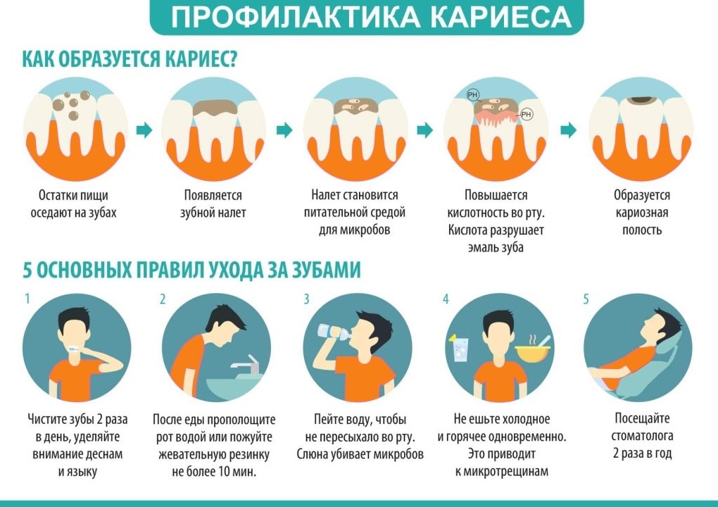 Всемирный день борьбы против кариеса