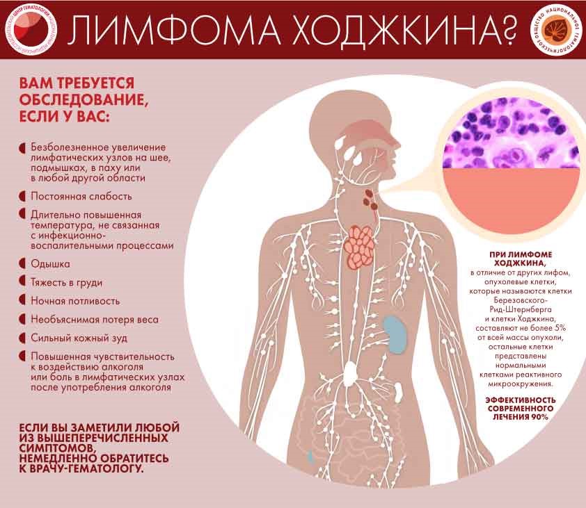 Всемирный день борьбы с лимфомами