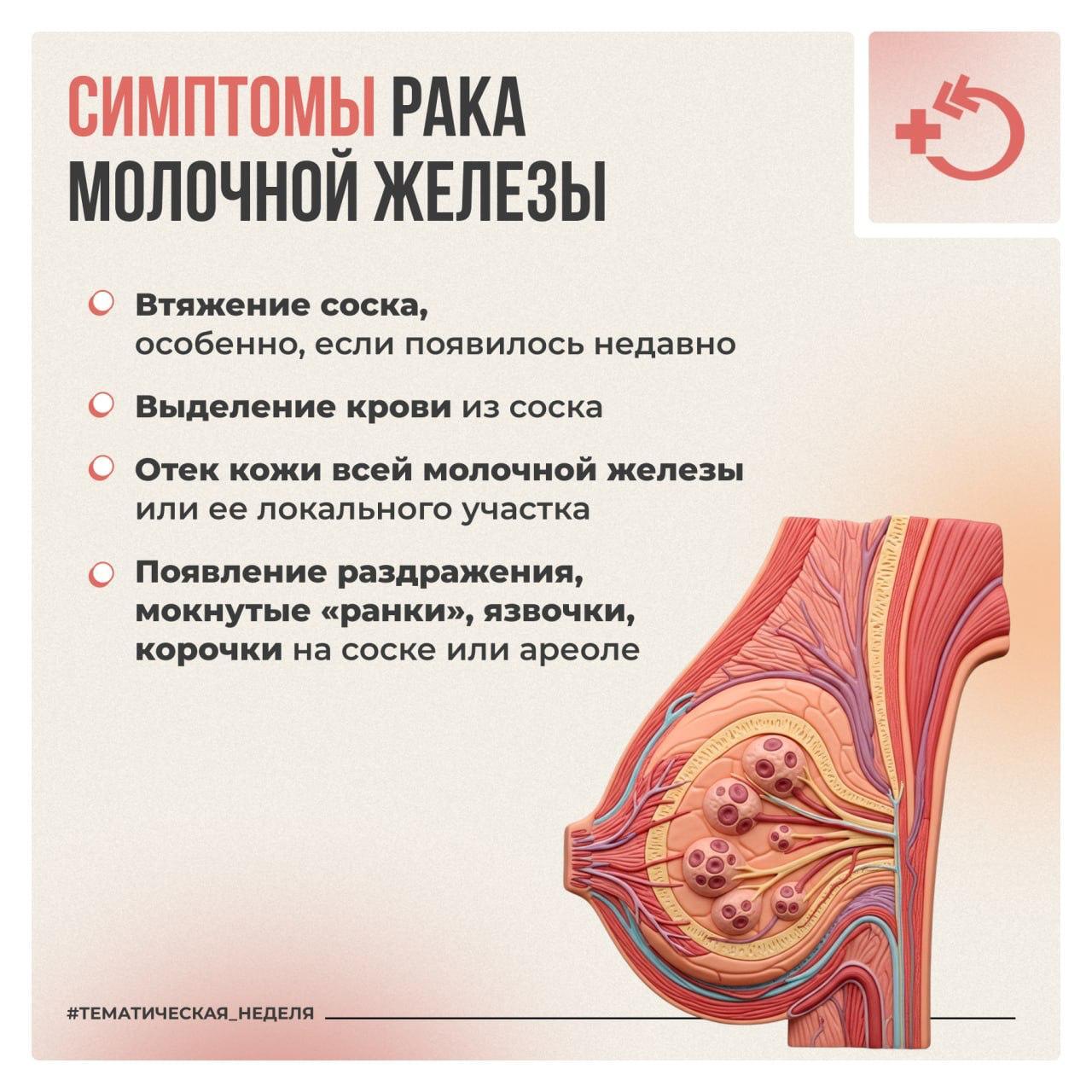 Всемирный день борьбы с раком молочной железы