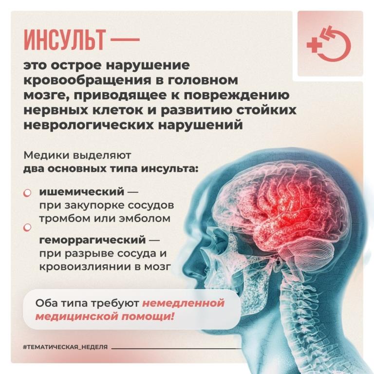 Всемирный день борьбы с инсультом